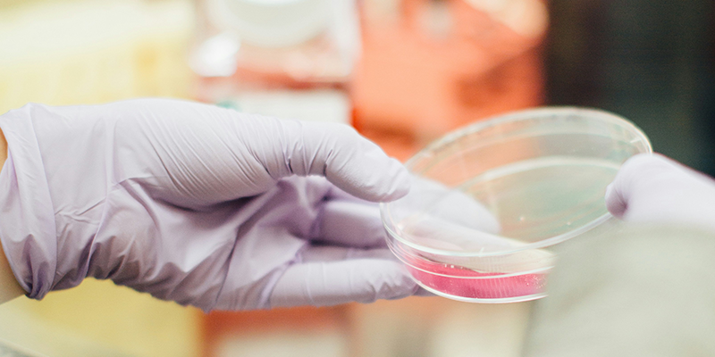 活菌計(jì)數(shù)效率瓶頸如何破？博大博聚微生物細(xì)胞計(jì)數(shù)儀的實(shí)踐方案